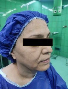 Operation room for Facelift surgery