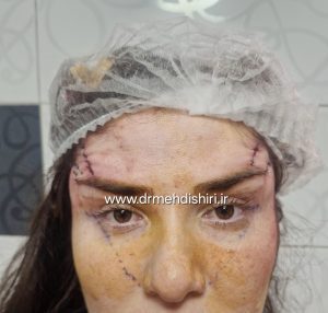 کشیدگی زیبای گوشه ابرو و چشم